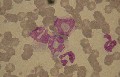 monocytose
