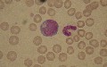 promonocyte