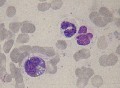 précursseur eosinophilique