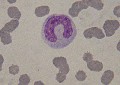 metamyelocyte chat