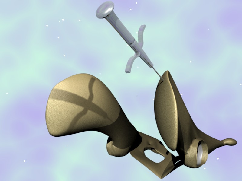 myélogramme